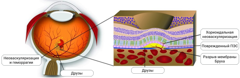 Рис 1