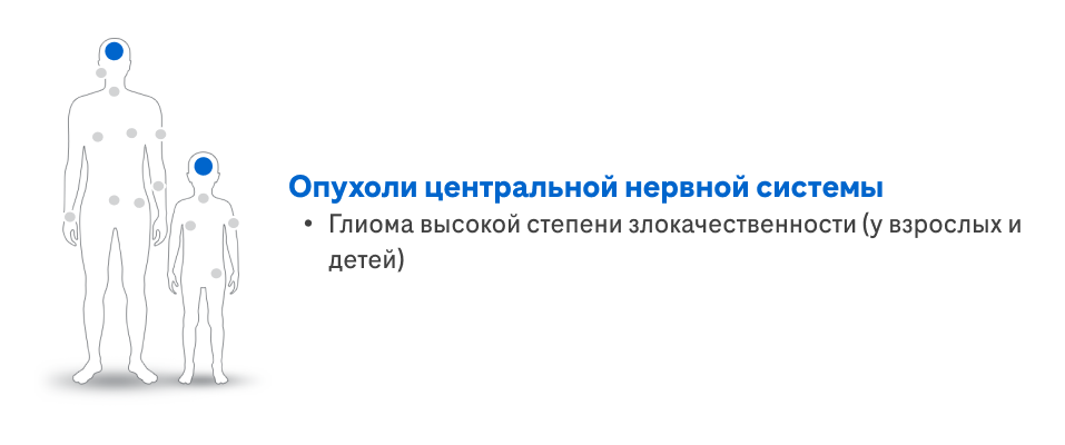 Опухоли ЦНС