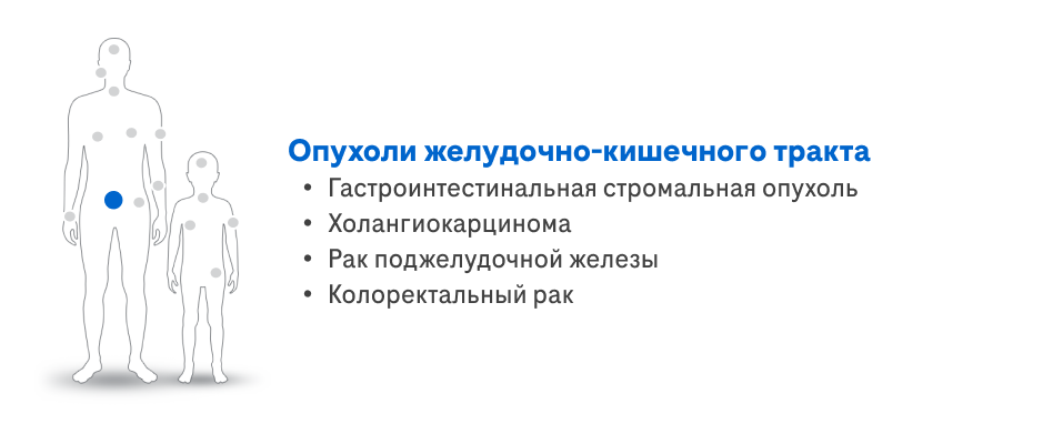 Опухоли желудочно-кишечного тракта