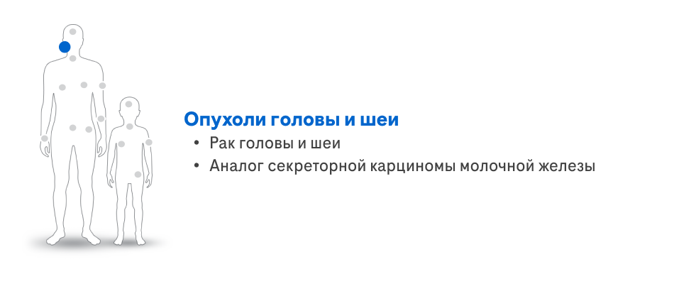 Опухоли головы и шеи