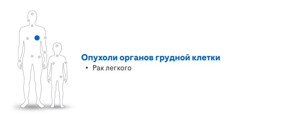 Опухоли органов грудной клетки