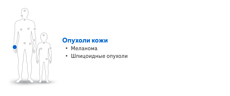 Опухоли кожи