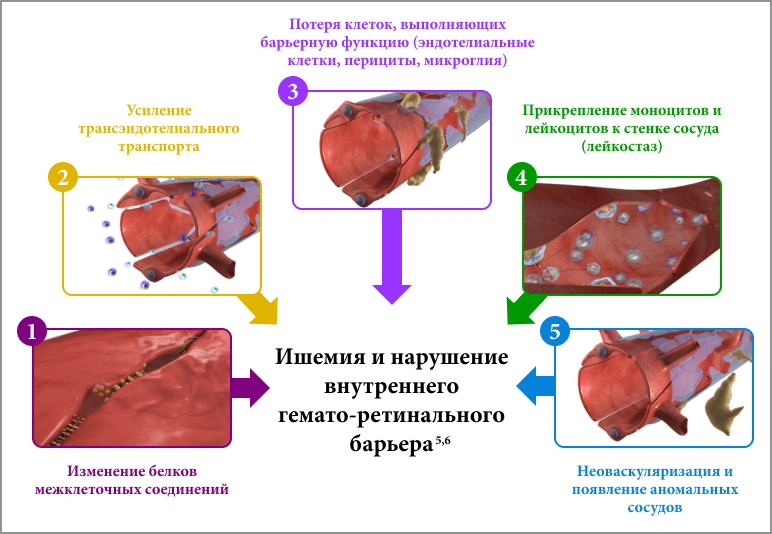 Рис 1