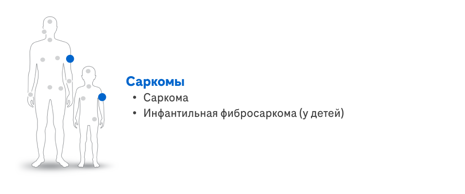 Саркомы